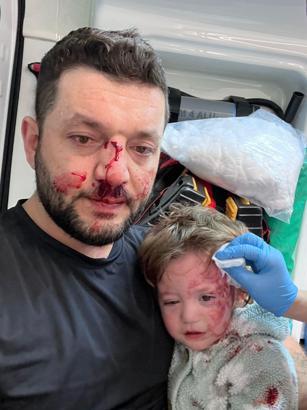 İkra ile babasının darbedilmesine ilişkin iddianame hazırlandı; çocuk skuter'ı 'silah' olarak sayıldı