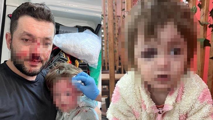 İkra ile babasının darbedilmesine ilişkin iddianame hazırlandı; çocuk skuter'ı 'silah' olarak sayıldı