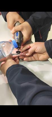 Parmağına sıkışan yüzüğü itfaiye çıkardı