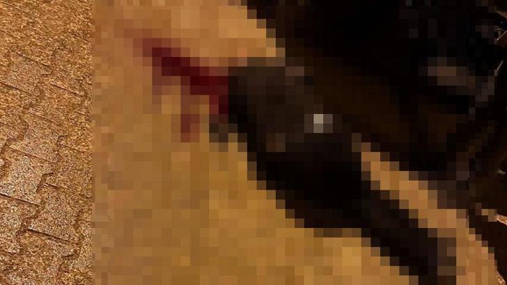 Sokakta yürürken tabanca ile başından vuruldu