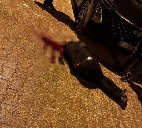 Sokakta yürürken tabanca ile başından vuruldu