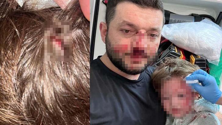 Kucağında bebeği ile darbedilen babanın oğlu, sokakta başına atılan taşla yaralandı