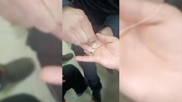 Parmağına sıkışan yüzüğü itfaiye ekipleri çıkardı