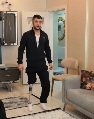 Akın motosiklet kazasında bacağını kaybetti, hayırseverler 450 bin liralık protezle yürümesini sağladı