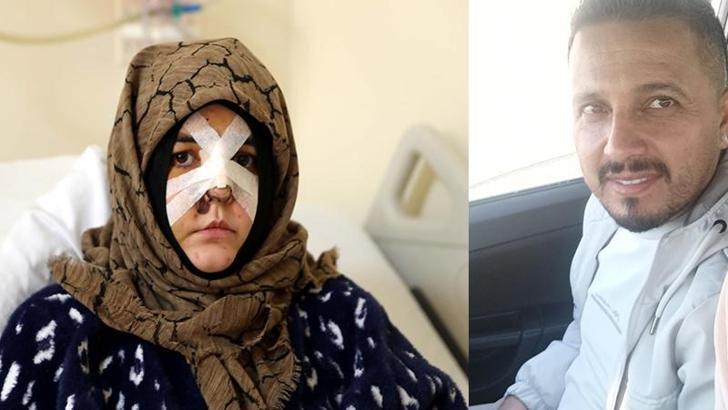 Boşanma aşamasındaki eşine vurduğu kaldırım taşı 'silah' sayıldı