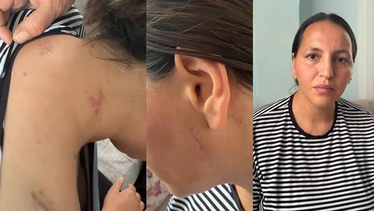 17 bıçak darbesiyle yaralanan Havva, tutuklanan eşinin en ağır cezayı almasını istedi