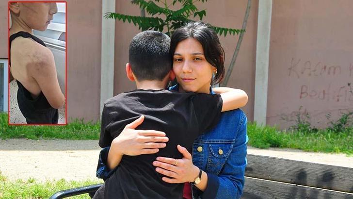 Babasının darbettiği 12 yaşındaki çocuk koruma altına alındı