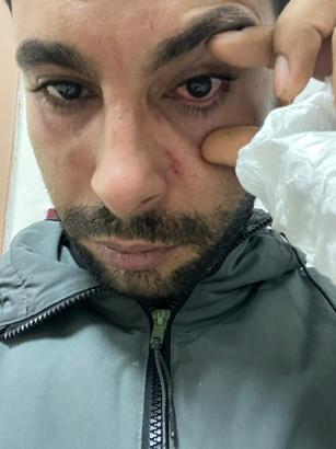 Hastaya yumruk attığı iddiasıyla doktora dava