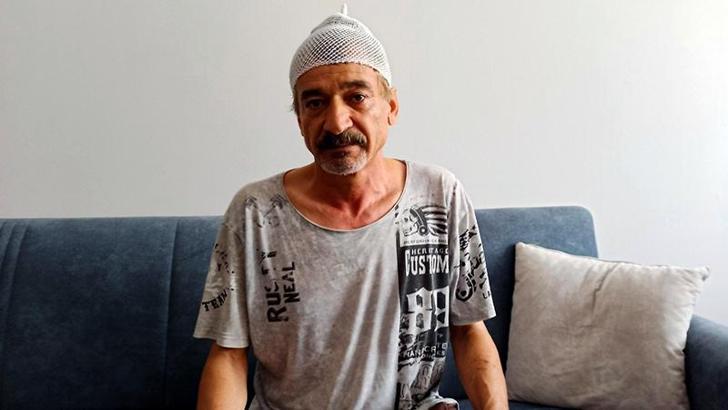 Çay içerken başına beton parçası düştü