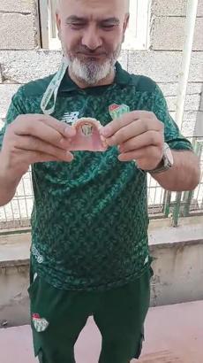 Bursaspor’un fanatik taraftarı takma dişinin damağına da kulüp amblemi yaptırdı