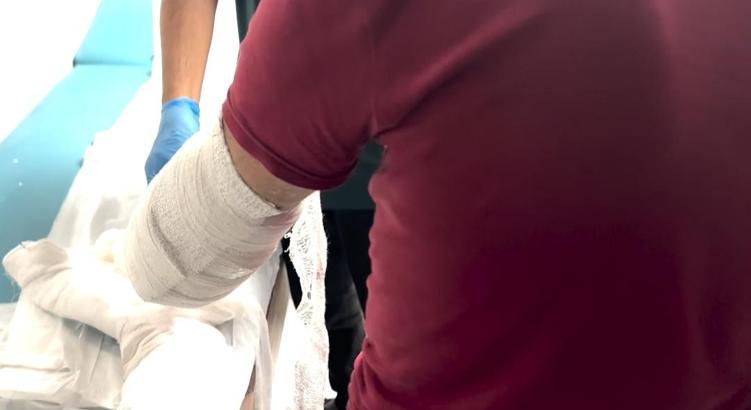 Kolundaki alçıda 1 kilo uyuşturucuyla yakalanan şüpheli tutuklandı