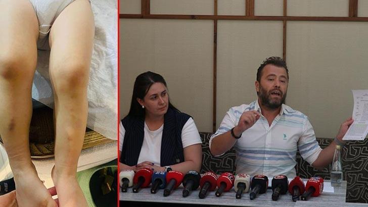 Kreşte 2 yaşındaki çocuğa darp iddiasına takipsizlik kararı