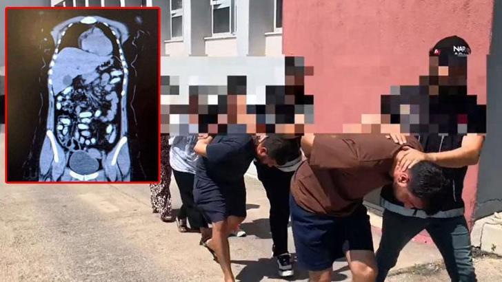 Midesinde 1,5 kilo metamfetaminle yakalanan 2 kadın kurye tutuklandı