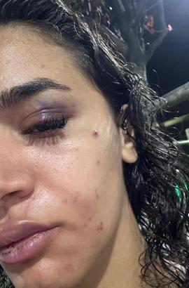 Bahçeşehir'de uzaklaştırma kararına rağmen evinin önünde darbedilen Ebru: Ölmeden önce sesimi duyun