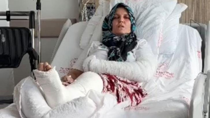 Kavgada 3 çocuk annesinin kolu ve bacağı kırıldı