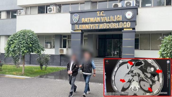 Midesinden uyuşturucu çıkan şüpheli tutuklandı