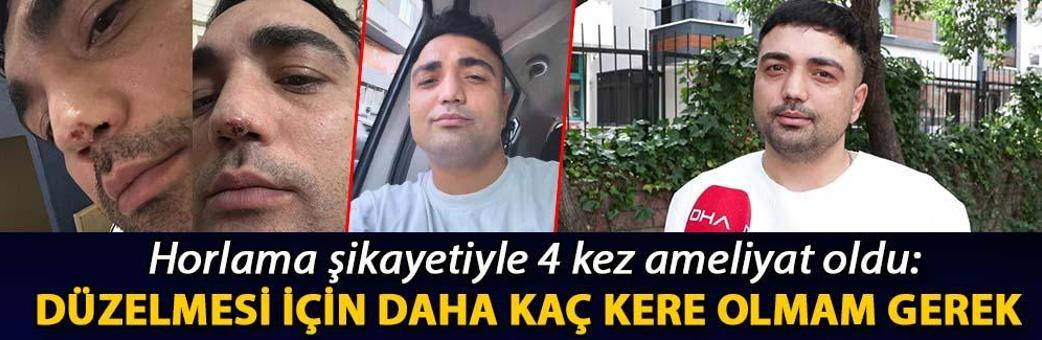 Horlama şikayetiyle 4 kez ameliyat oldu: Düzelmesi için daha kaç kere olmam gerek