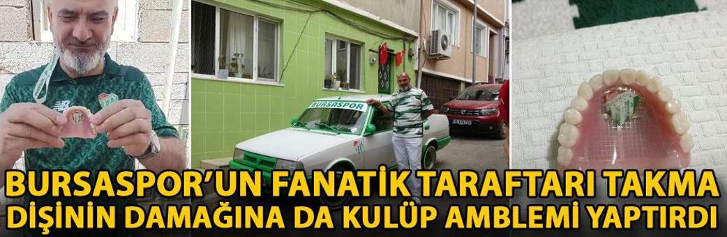Bursaspor’un fanatik taraftarı takma dişinin damağına da kulüp amblemi yaptırdı