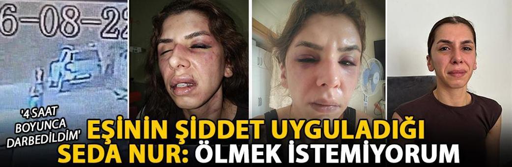 Eşinin şiddet uyguladığı Seda Nur: Ölmek istemiyorum