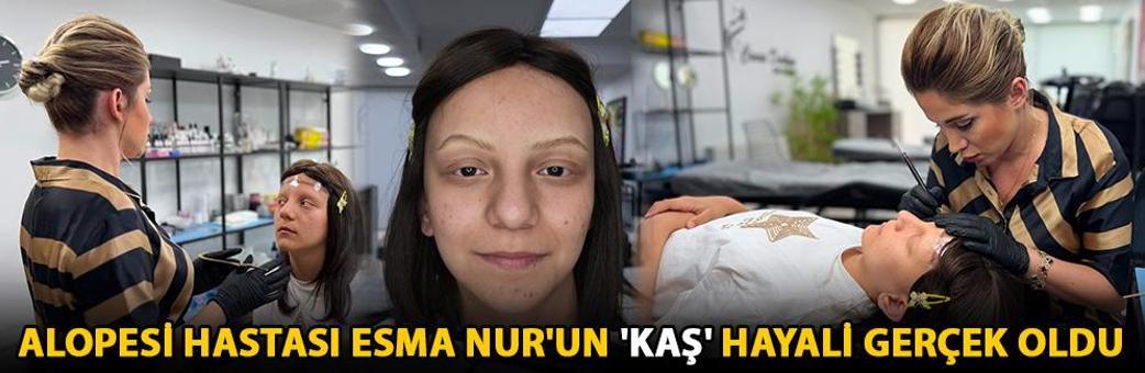 Alopesi hastası Esma Nur'un 'kaş' hayali gerçek oldu