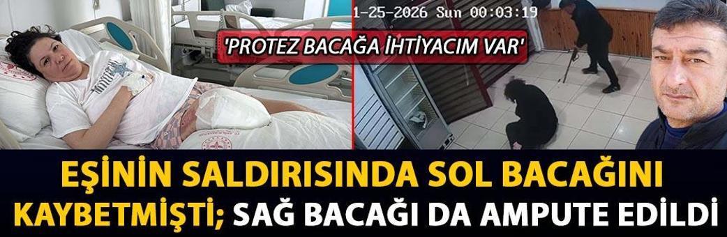 Eşinin saldırısında sol bacağını kaybetmişti; sağ bacağı da ampute edildi