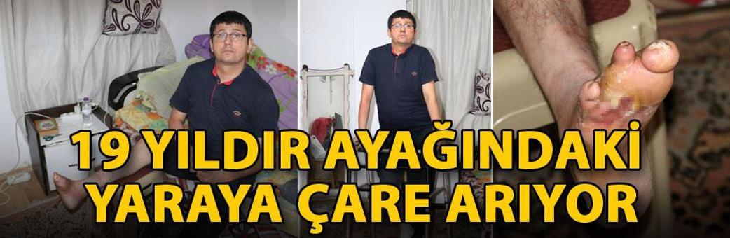 19 yıldır ayağındaki yaraya çare arıyor