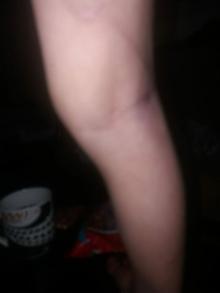 Küçük Eymen apartman görevlisine 'Annem beni kaldırıp yere attı' demiş