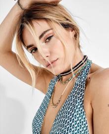 'Bacağını kesmeliyiz' denilen ünlü top model Türkiye'de yürüdü