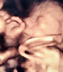 Anne karnındaki bebeklerin gülümseten pozları