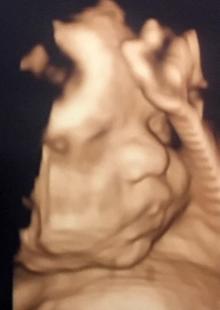 Anne karnındaki bebeklerin gülümseten pozları