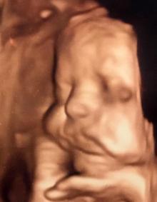 Anne karnındaki bebeklerin gülümseten pozları