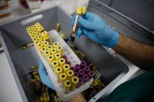 İSLAB Projesi ile İstanbul'un tüm testleri tek çatı altında