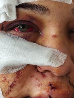 Polis eşi tarafından darbedildiği iddiasıyla şikayetçi oldu