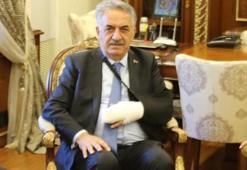 Hayati Yazıcı kaza geçirdi, sol eli alçıya alındı