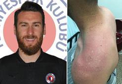 Fethiyespor'da darp iddiası