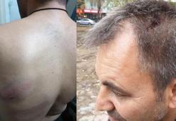 Valilikten, yerel gazete sahibine saldırıya ilişkin açıklama