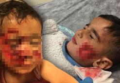 Viranşehir'de köpek saldırısına uğrayan küçük Davut, kurtarılamadı