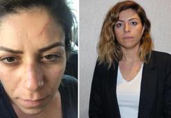 Boşandığı eşinden şiddet gören avukat: Tutuklama tedbiri ben öldükten sonra mı uygulanacak?