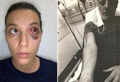 Ozan Güven'in şikayetçi olduğu soruşturmada uzlaşma sağlanamadı