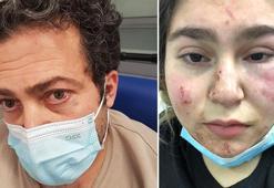 Almanya’da polisin kızıyla birlikte dövdüğü Türk konuştu