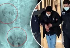 Otogarda rahatsızlanan İranlının midesinde 890 gram uyuşturucu çıktı