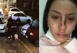 Polisin dövdüğü kadına emniyet müdüründen çiçek