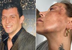 'Dayakçı sevgili'ye tahliye