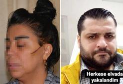 Eski sevgilisinin yüzünü ustura ile kesen şüpheli, tutuklandı