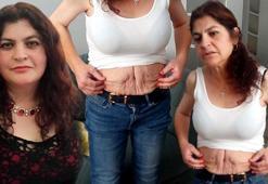 3 ameliyat geçirdi, estetik operasyonlar sonrası hayatı kabusa döndü