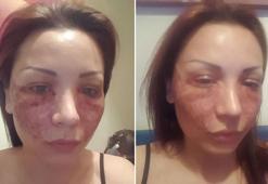 Bulgar modelin estetik kabusu; kuaför kardeşler: Örümcek ağı yapmadık, iftira