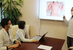 Prof. Dr. Selçuk Yüksel: Covid-19 çocuklarda saklı virüsleri tetikliyor