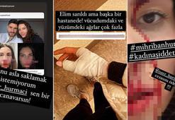 Futbolcu Özer Hurmacı eşini darp etti iddiası