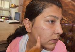 Mahkeme heyetinin kadın üyeleri, salonu boşaltıp Perkgün'ün yara izlerini inceledi