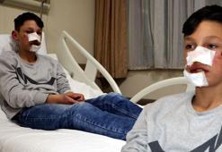 Ekmek almaya giden Berat, sokak köpeğinin saldırısıyla yaralandı